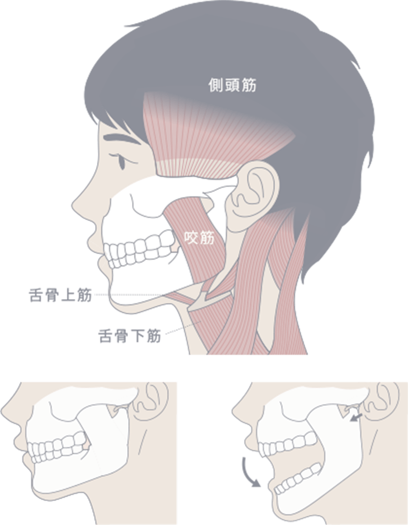 顎の運動による正しい咬み合わせと容貌のバランスを整える