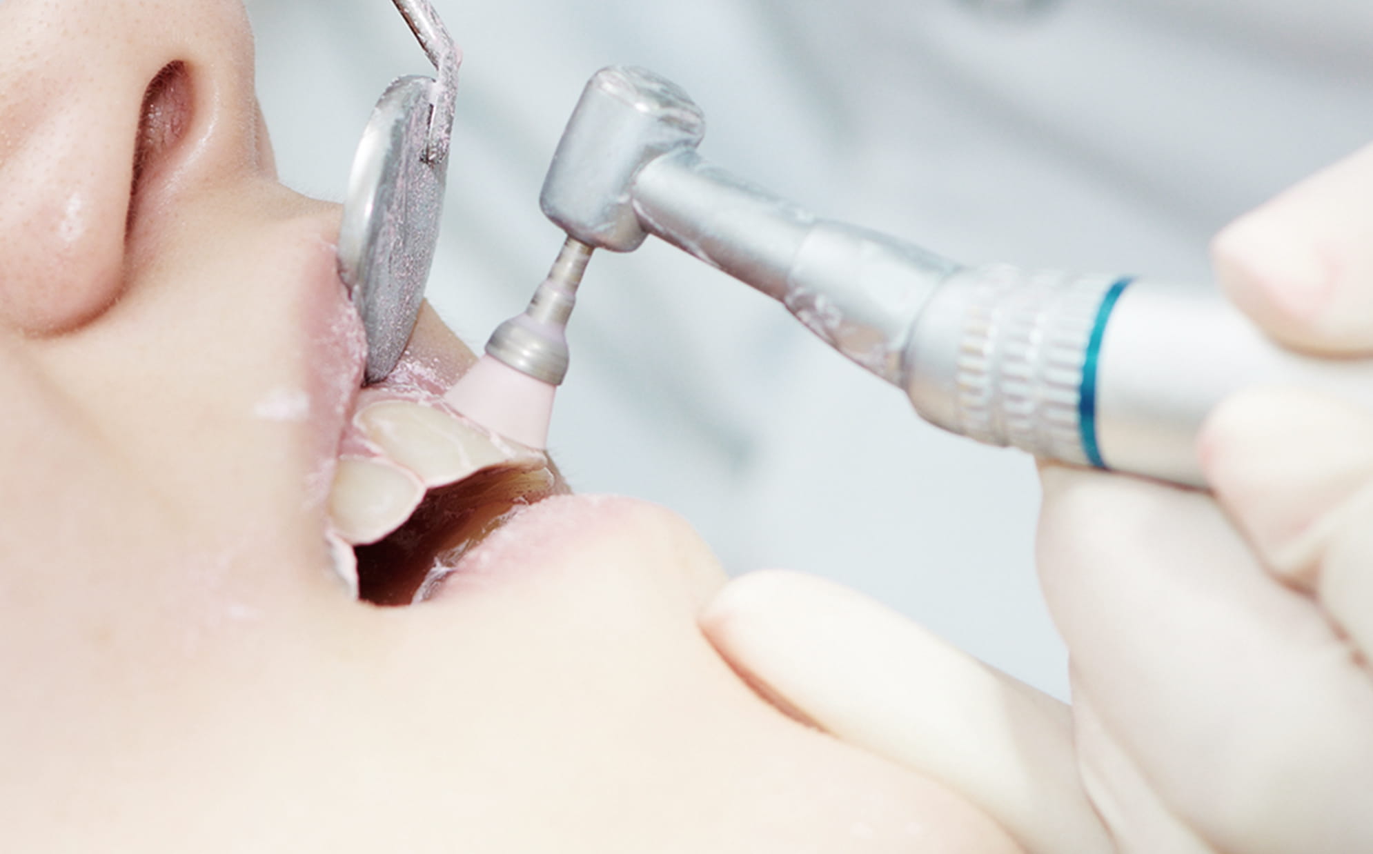 ドクター・歯科衛生士による 専門的なケアや処置