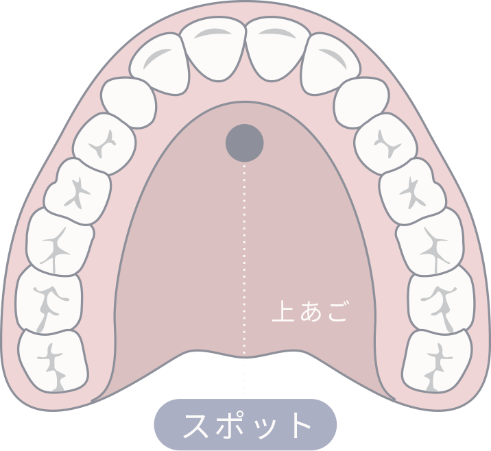 舌を上あごの「スポット」に収めるトレーニング
