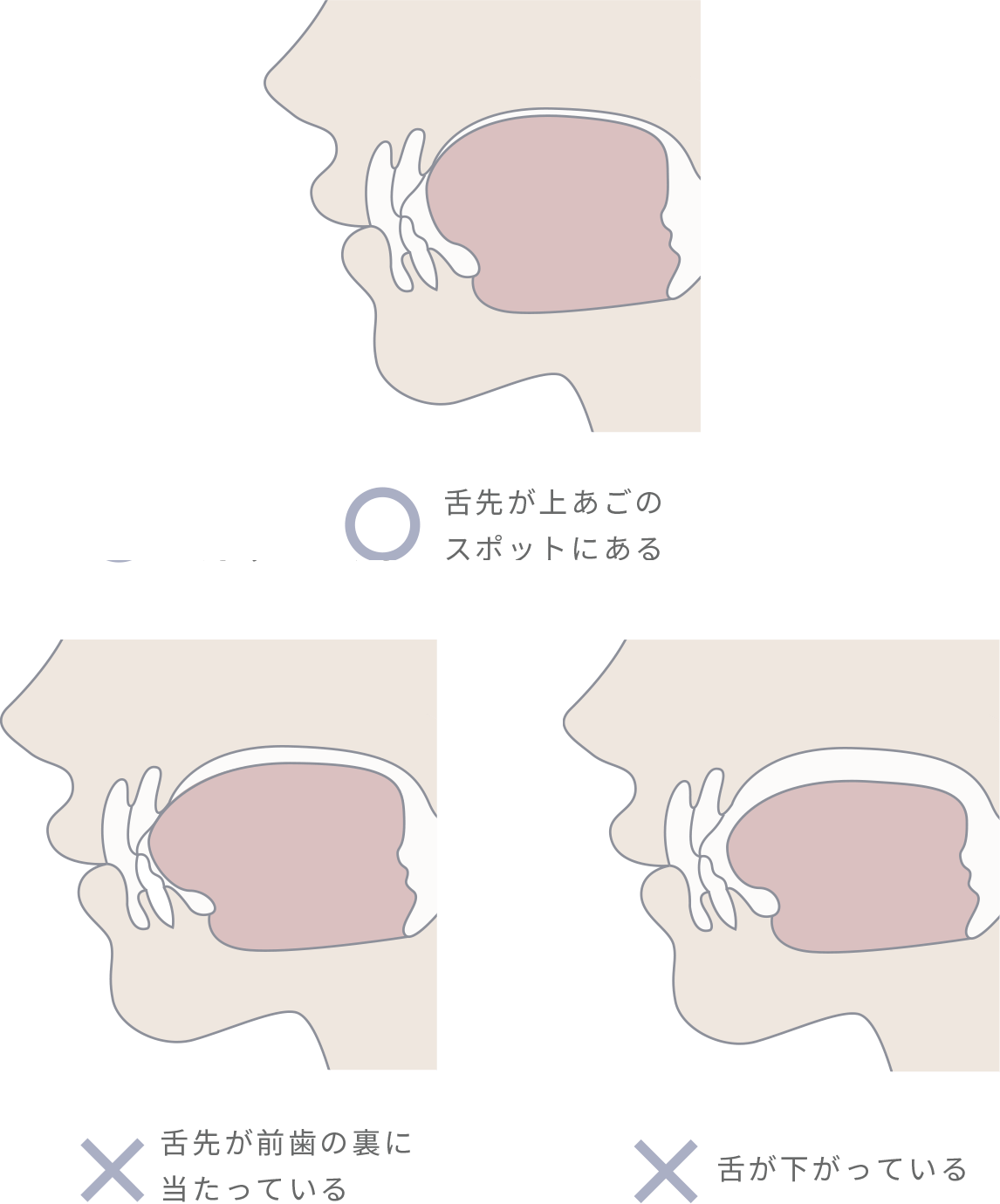 舌を上あごの「スポット」に収めるトレーニング