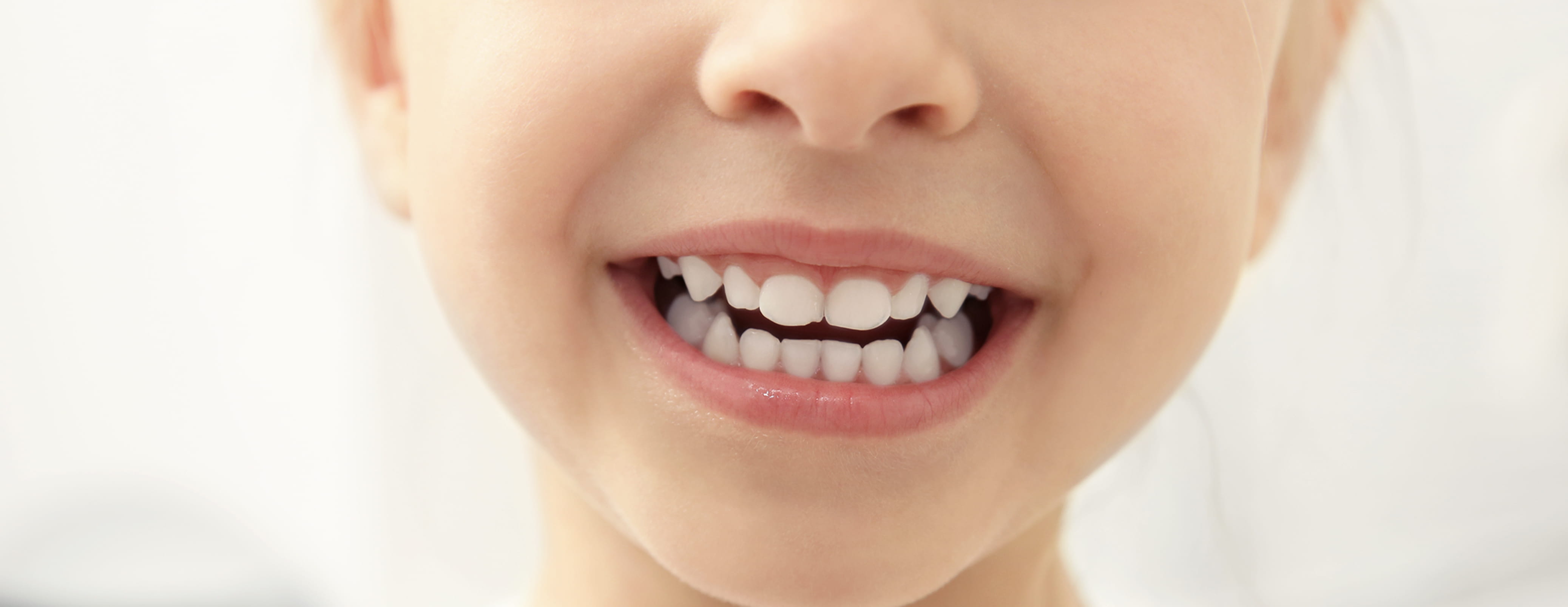 Orthodontics 小児矯正