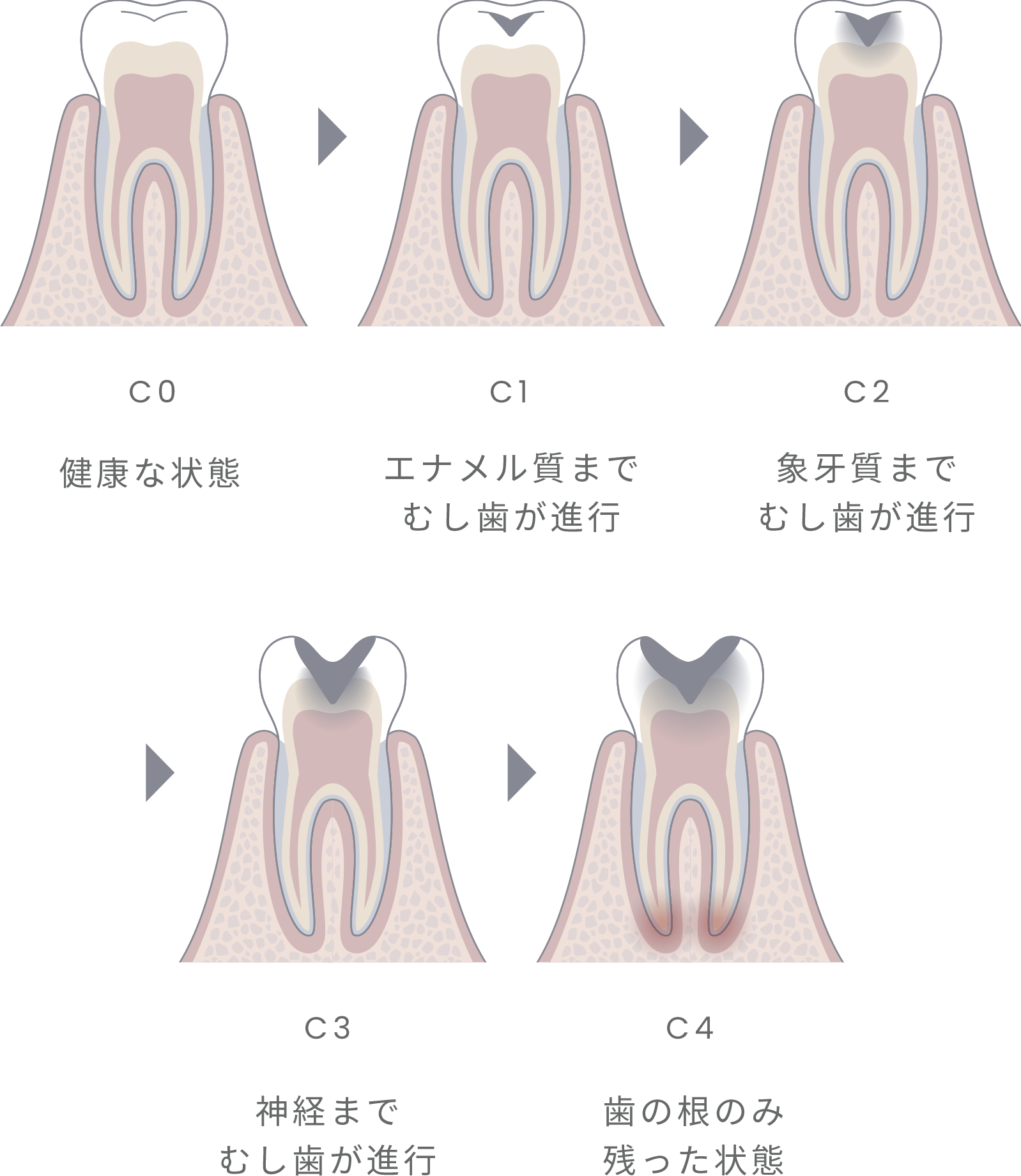 C0