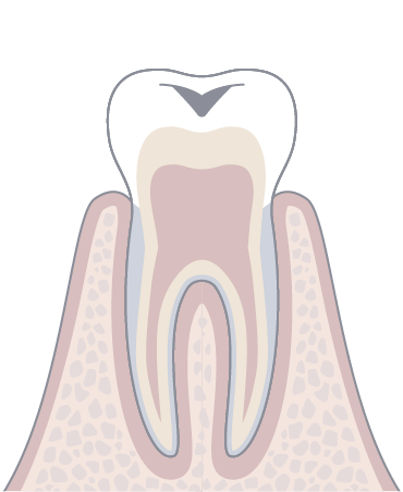 C1