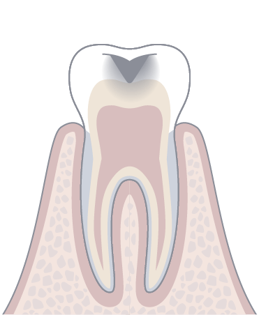 C2