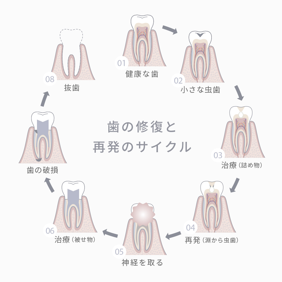 修復サイクルから考える再発リスクに備えた最適な治療アプローチ