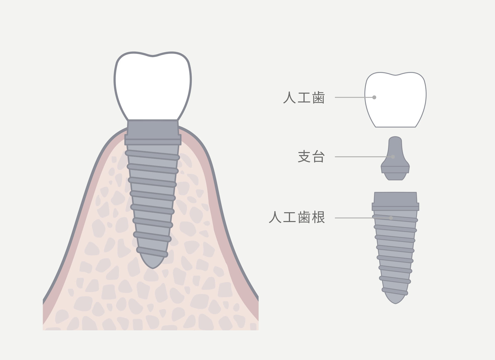 修復サイクルから考える再発リスクに備えた最適な治療アプローチ
