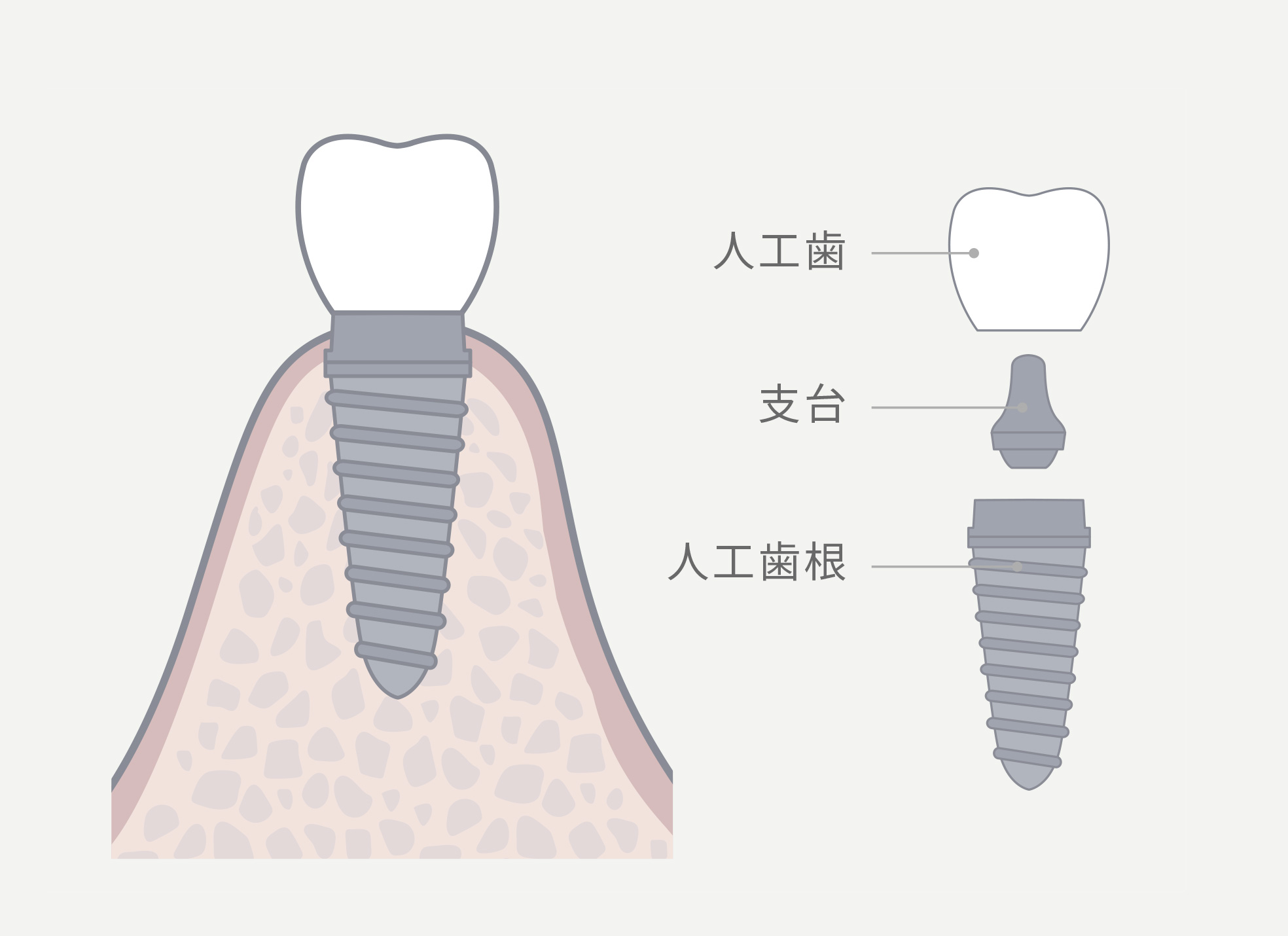 修復サイクルから考える再発リスクに備えた最適な治療アプローチ