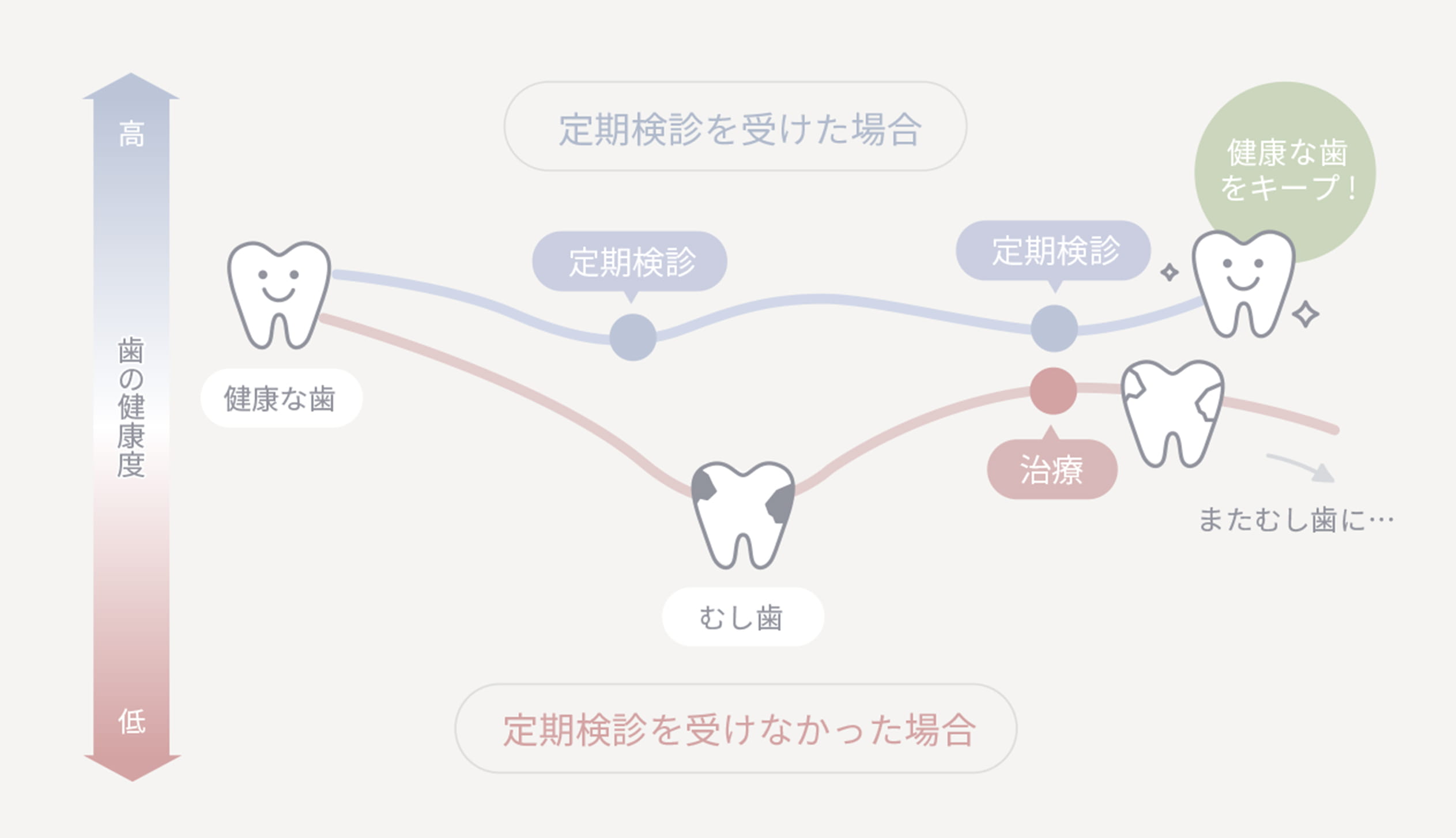 歯科での定期検診が 歯の寿命を伸ばす